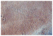Syria Planum
