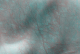 [thumbnail image]