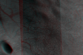 [thumbnail image]