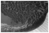 Basal Unit and Dunes