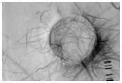 Stripped Exposure of Mineral Substrate