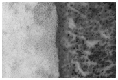Fractal Patterns in Seasonal Cap 