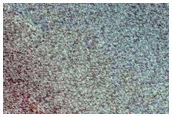 Sustained Bright Patches at Margin of North Polar Layered Deposits