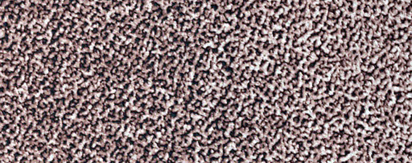 Sustained Bright Patches at Margin of North Polar Layered Deposits