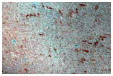 Sustained Bright Patches