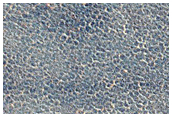Vastitas Borealis Terrain