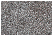 Vastitas Borealis Terrain Survey