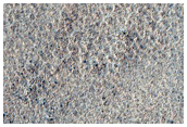 Intercrater Plains
