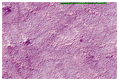 Immature Spider Terrain
