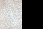 Features of Debris Apron in Deuteronilus Mensae