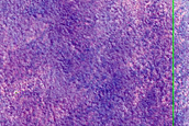 Acidalia Planitia