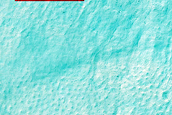 Gully Monitoring