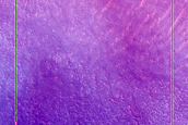 Dunes and Possible Frost