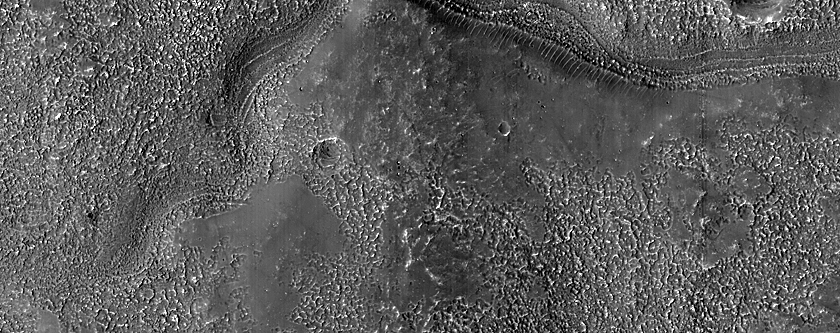 Channel Connected to Depression in Coracis Fossae