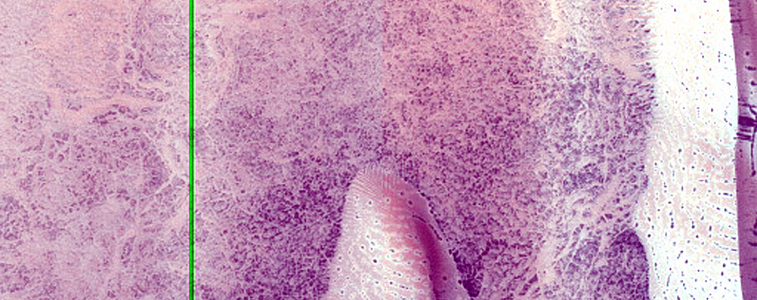 Dune Monitoring in Kunowsky Crater