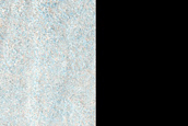 Butte and Patterned Ground in Deuteronilus Mensae