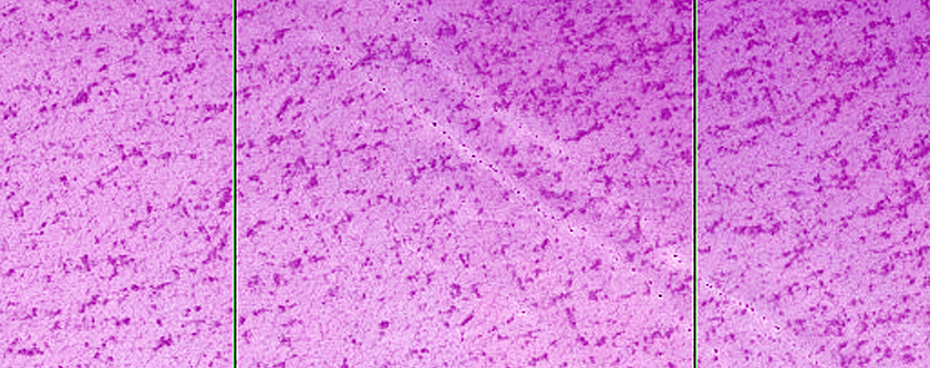 Pits in North Polar Residual Cap