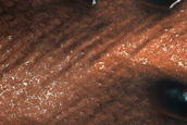 Dunes Dubbed North South Beach