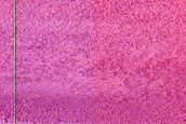 Ice-Sand Transition Area